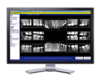 Digital X-rays - Lumber River Dental